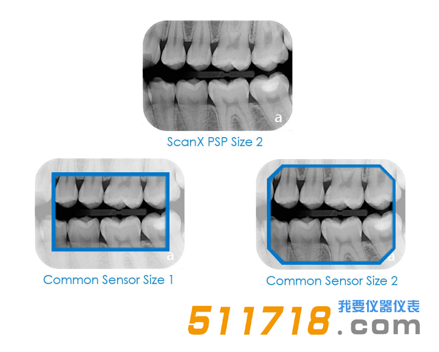 1557221931523171.png 美國(guó)AIR TECHNIQUES ScanX Duo數(shù)字X射線系統(tǒng) 口腔掃描儀2.png